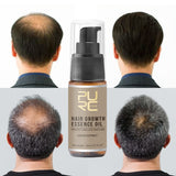 Fast Hair Growth Essence Oil